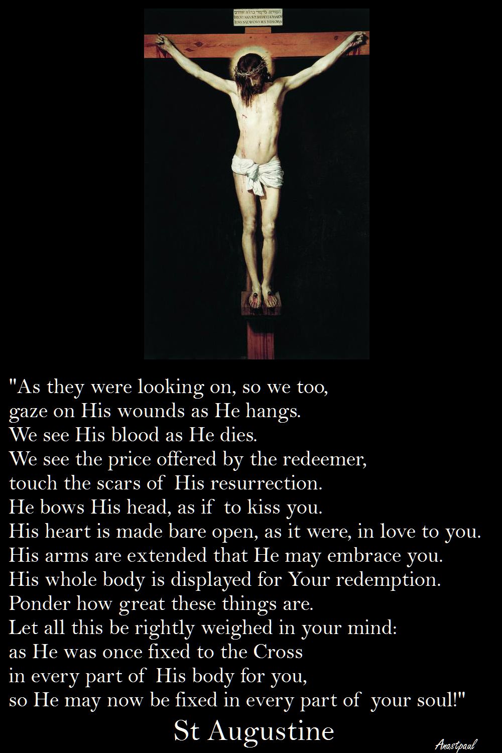 AS THEY WERE LOOKING ON SO WE TOO GAZE ON HIS WOUNDS-ST AUGUSTINE